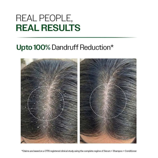 Anti-Dandruff Shampoo (250 ml) + Rosemary Water Spray for Hair Growth & Thickness (200 ml) | Reduces Dandruff, Strengthens Hair, 100% Natural Extracts | Non-Greasy, Fast Absorbing |